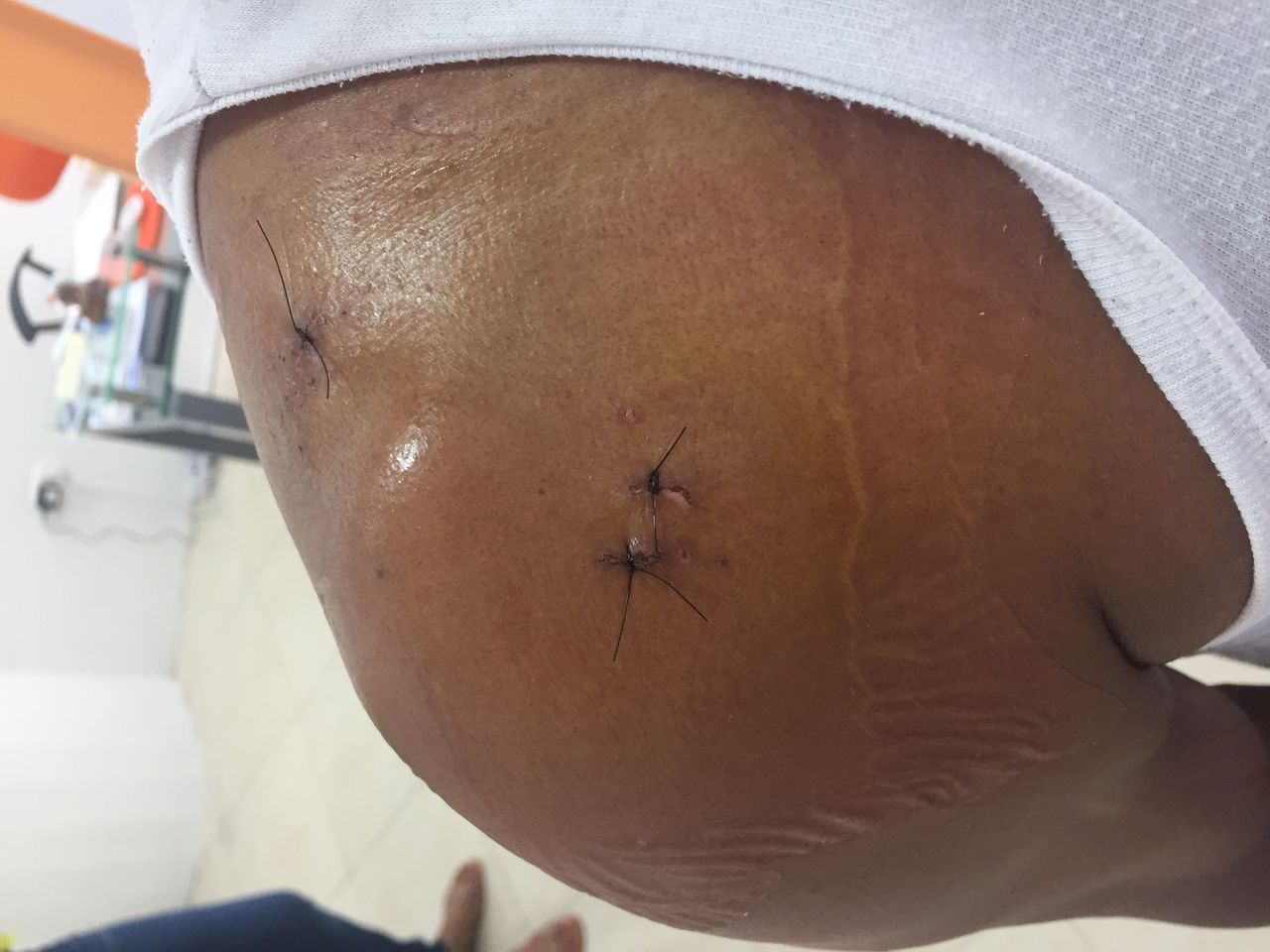 Andres De La Espriella Rosales-44