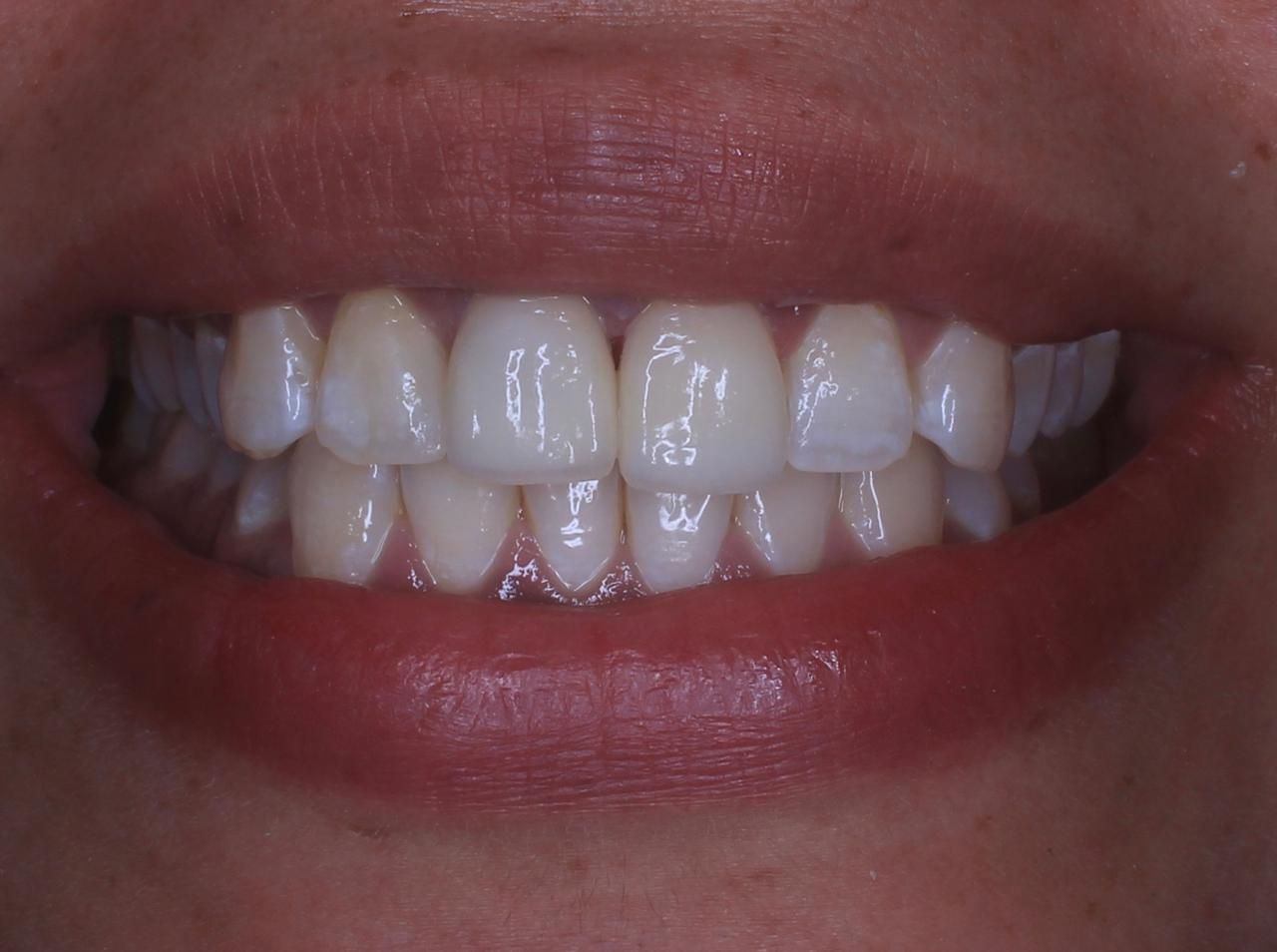 Francisco Bahamonde-4