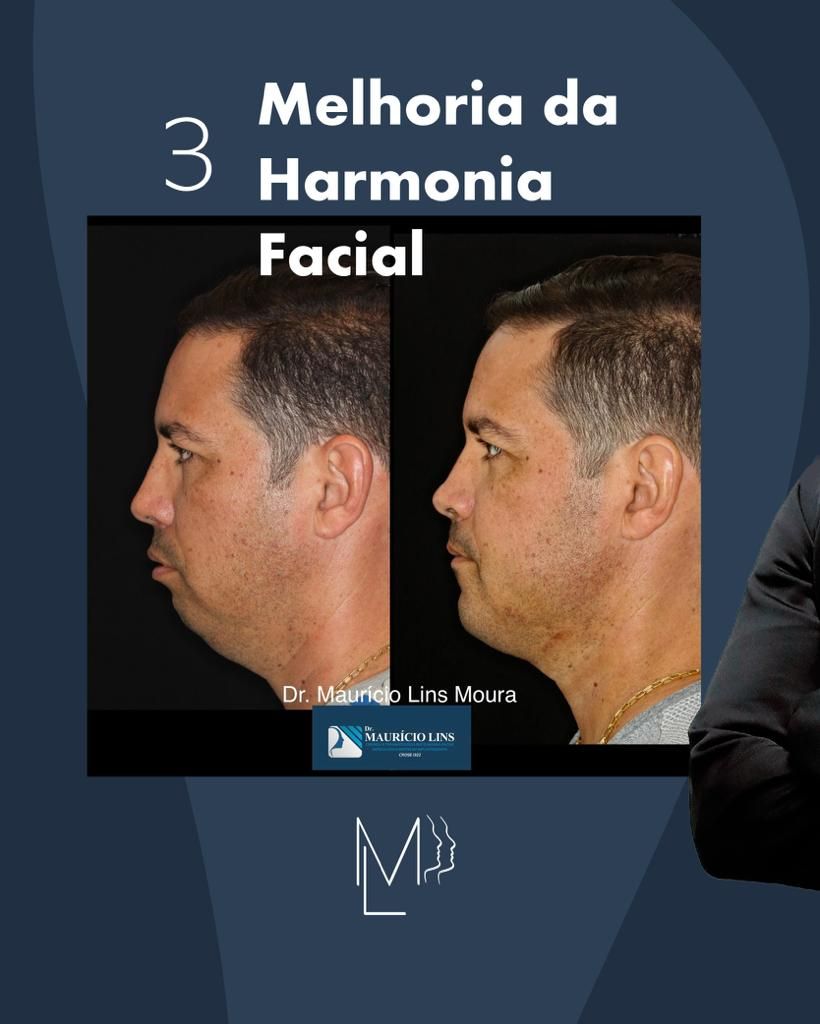 Mauricio Lins Moura-12