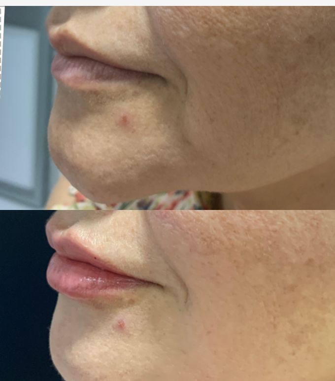 Maria Gisela Angel Losada-6