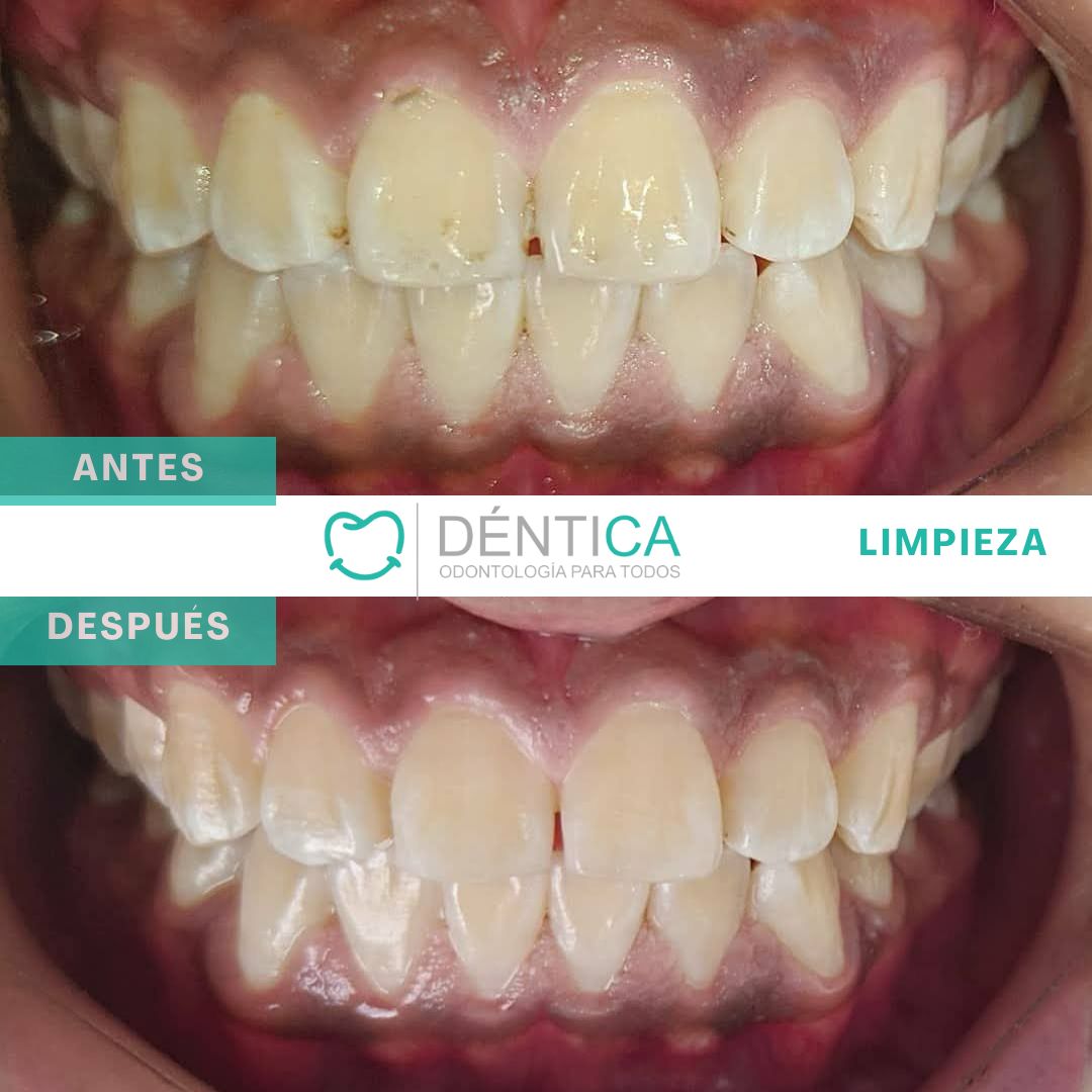 Estefani Canches Caballero-12