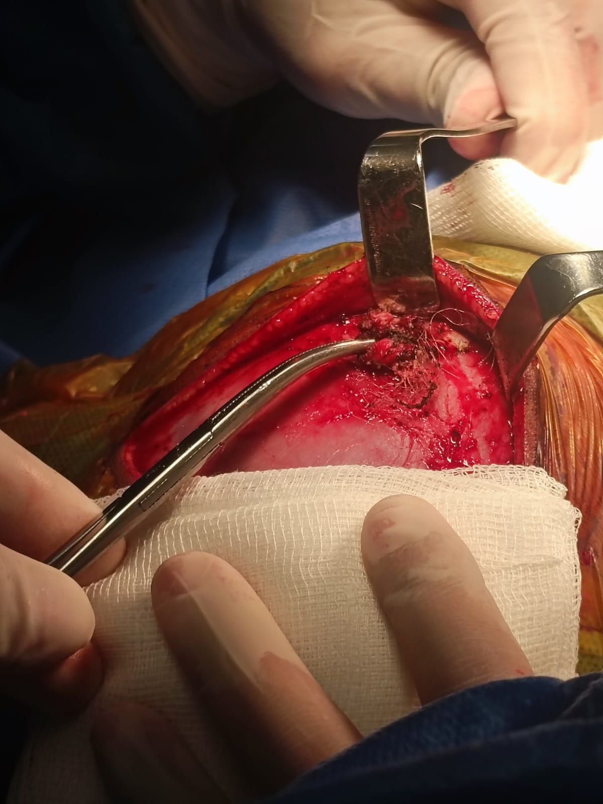 David Tafur Muñoz-1018