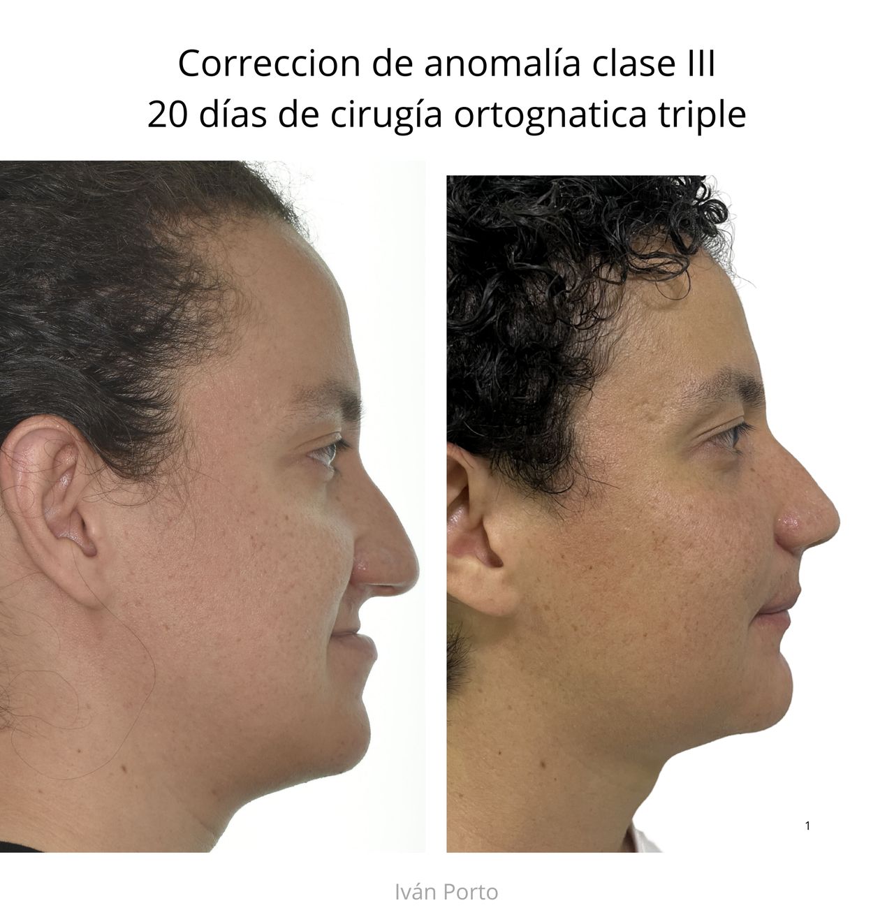 Iván Porto Puerta-3