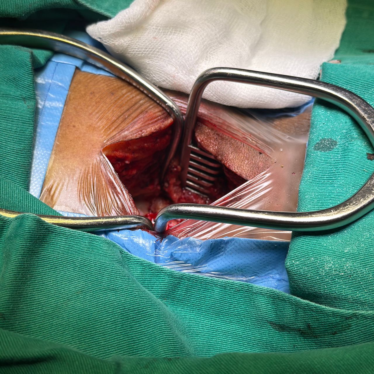 David Tafur Muñoz-2420