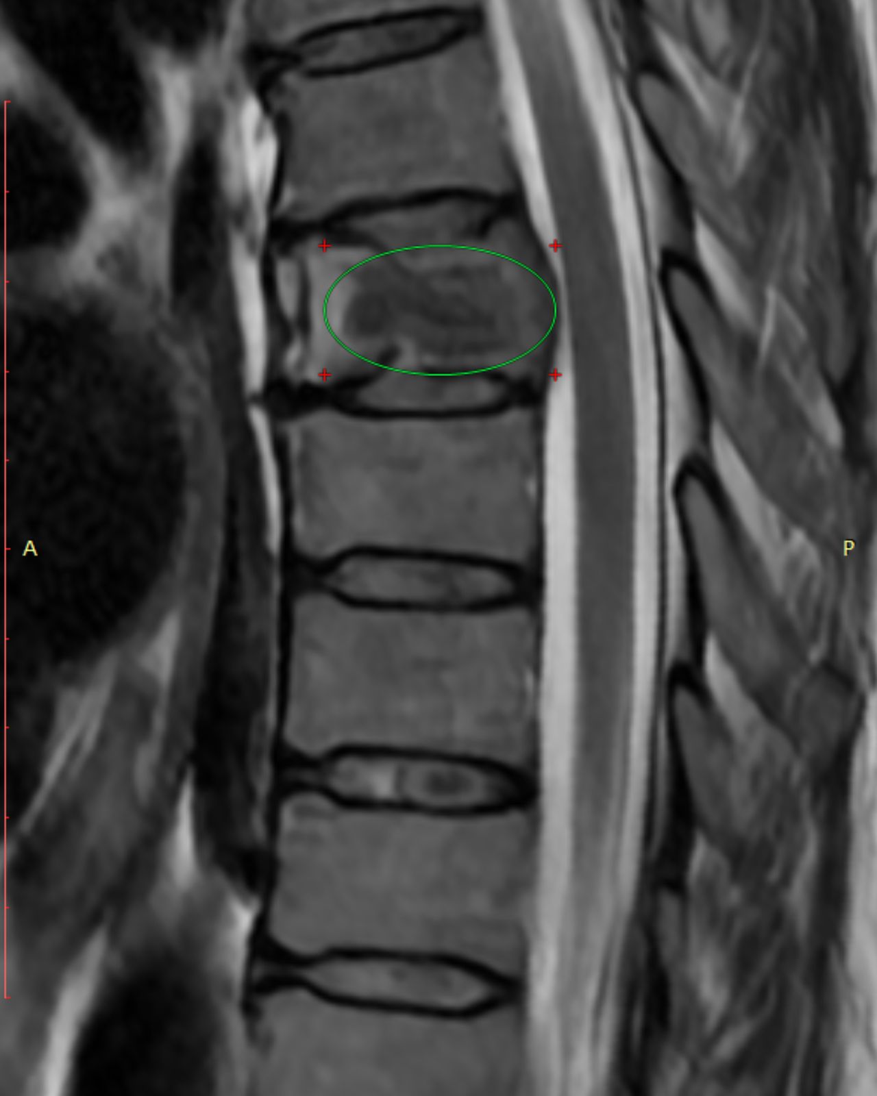 David Tafur Muñoz-2200