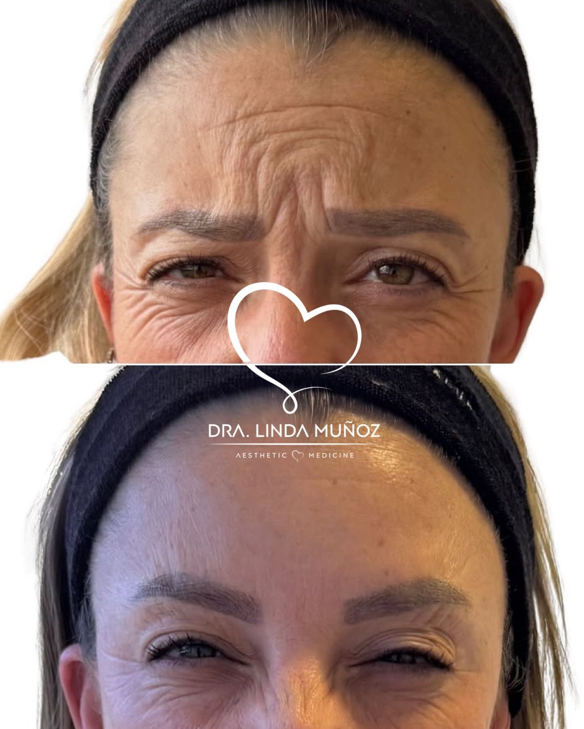 Linda Muñoz-42