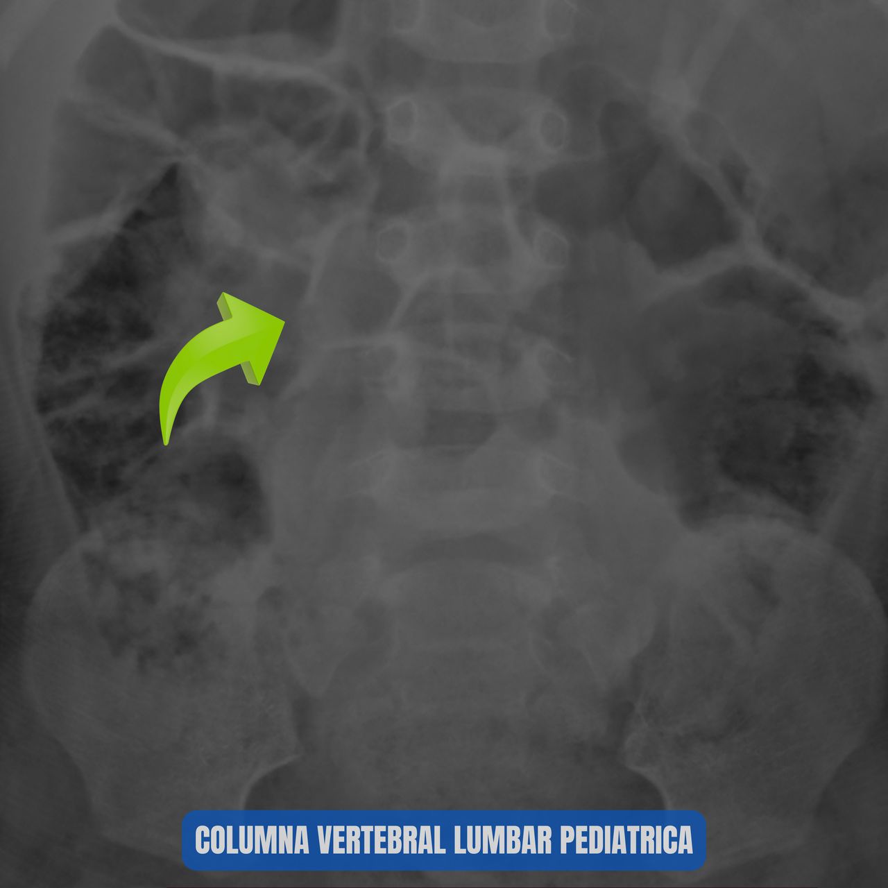 David Tafur Muñoz-1881