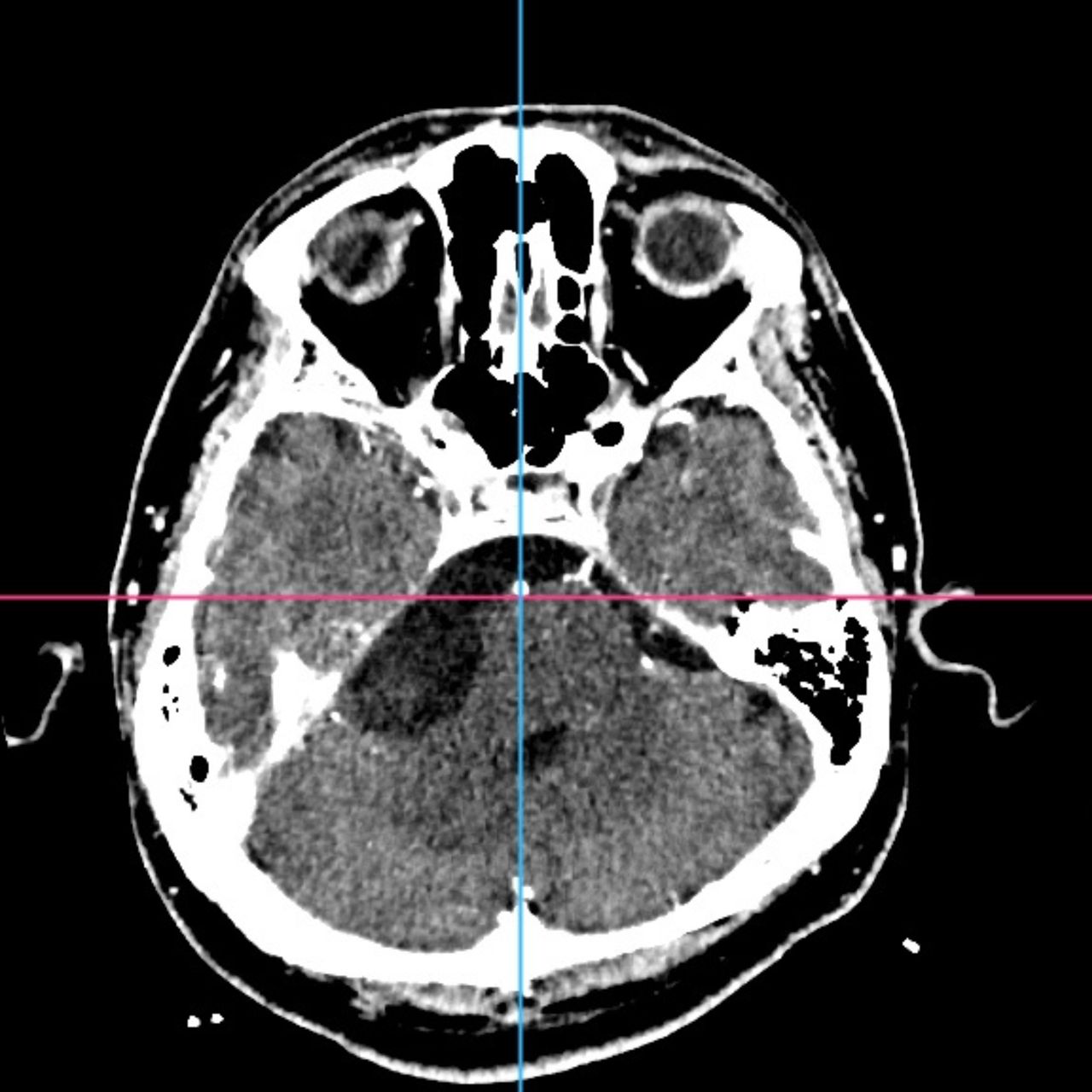 David Tafur Muñoz-1497