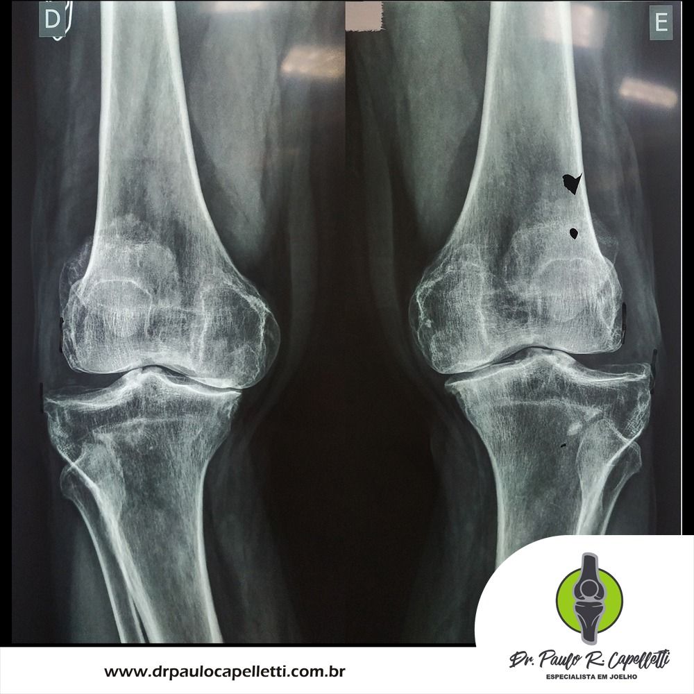 Paulo Roberto Capelletti-77