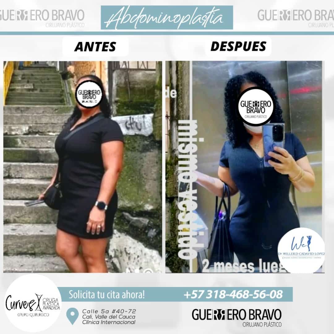 Camilo Guerrero Bravo-26