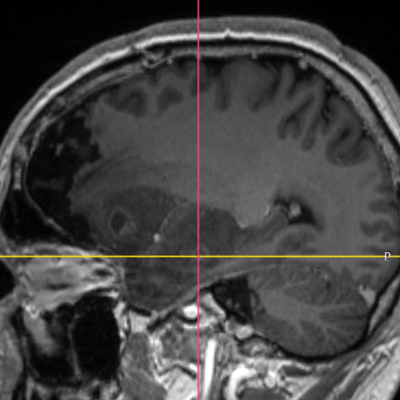 David Tafur Muñoz-1632