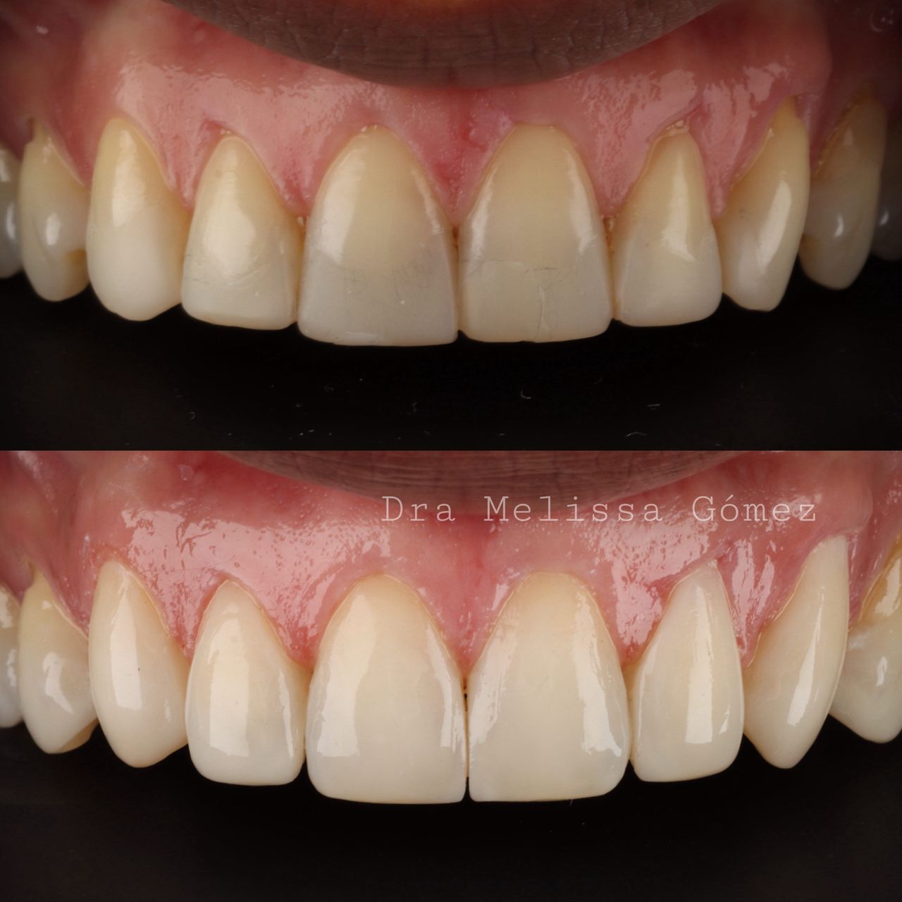 Melissa Gómez Arango-22