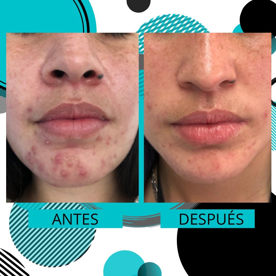 David Eduardo Reyes Jaramillo-6