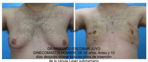 Armando Escobar Juyo-45