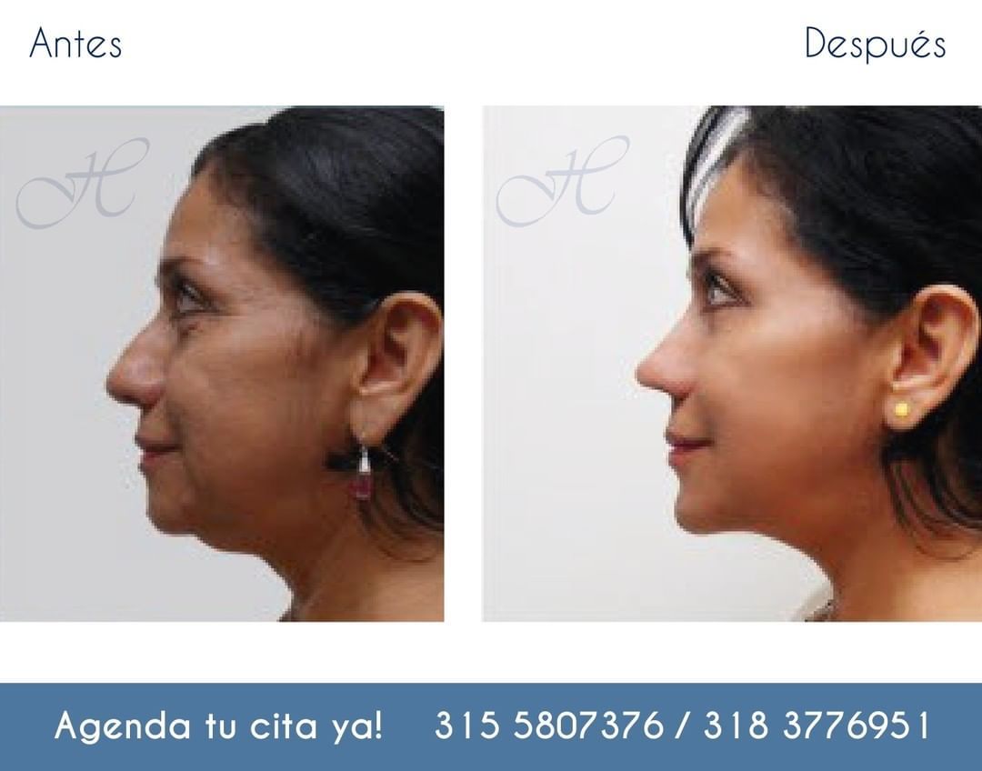 Jorge A Holguin Ruiz-49