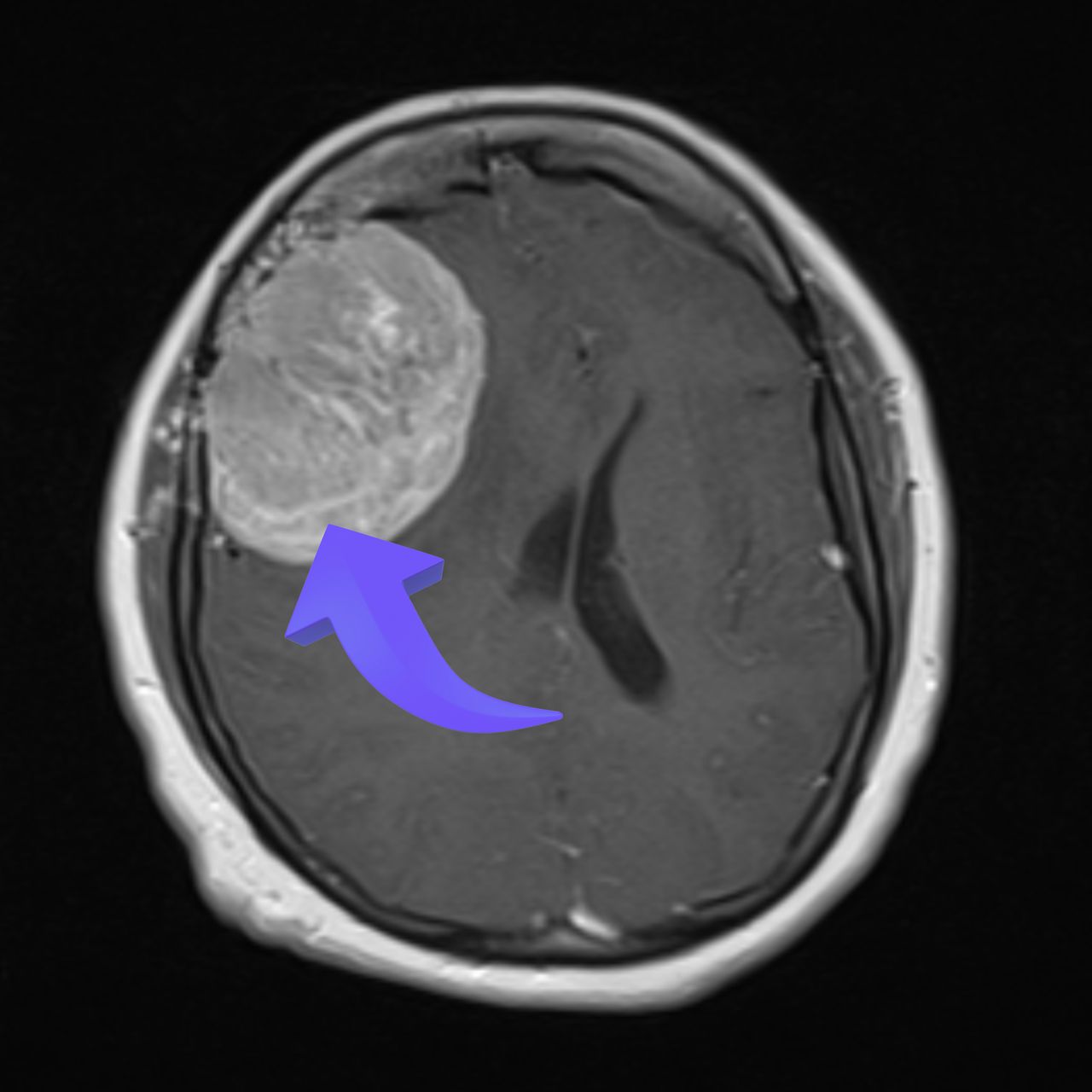 David Tafur Muñoz-1970