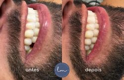 Lorenzo Mendonça Pinto-3