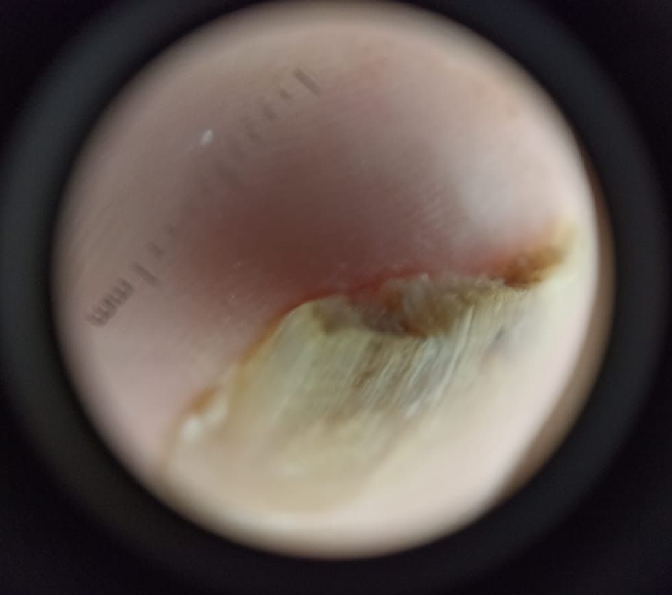 Marcos Ortiz Perez-11