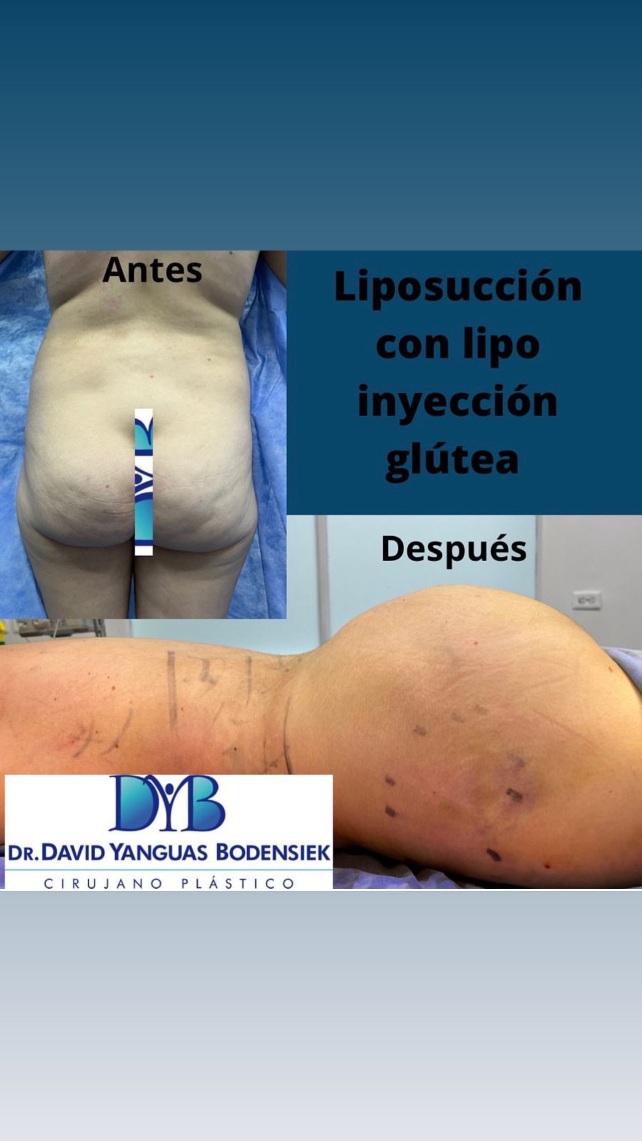 David Yanguas Bodensiek-13