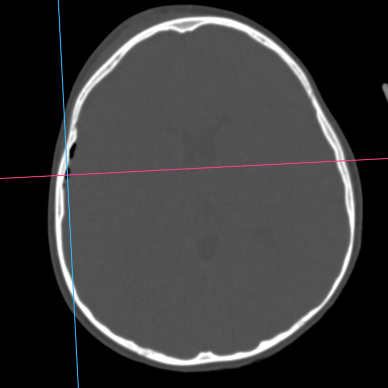 David Tafur Muñoz-2241