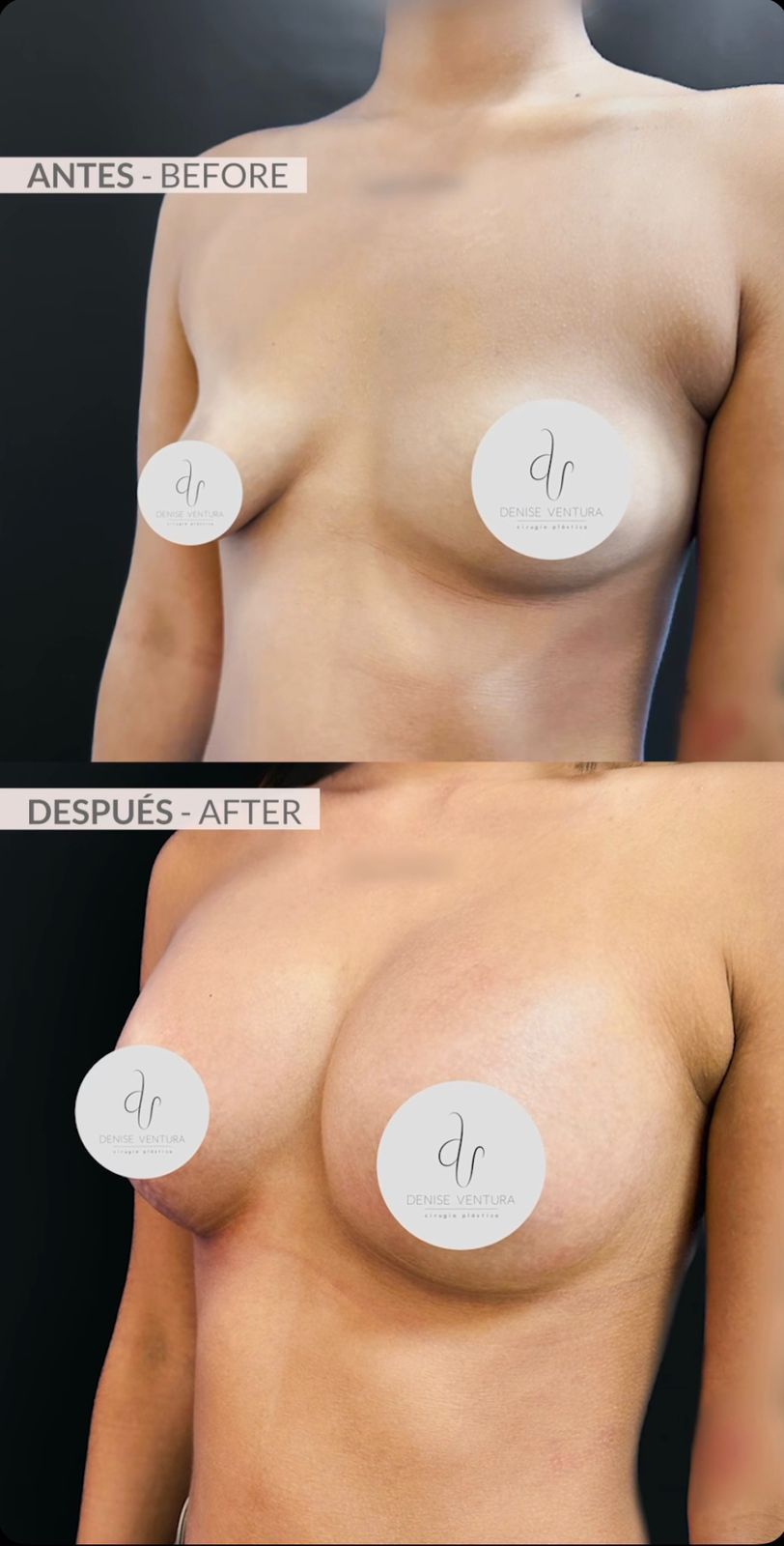 Denise Ventura Perez-4