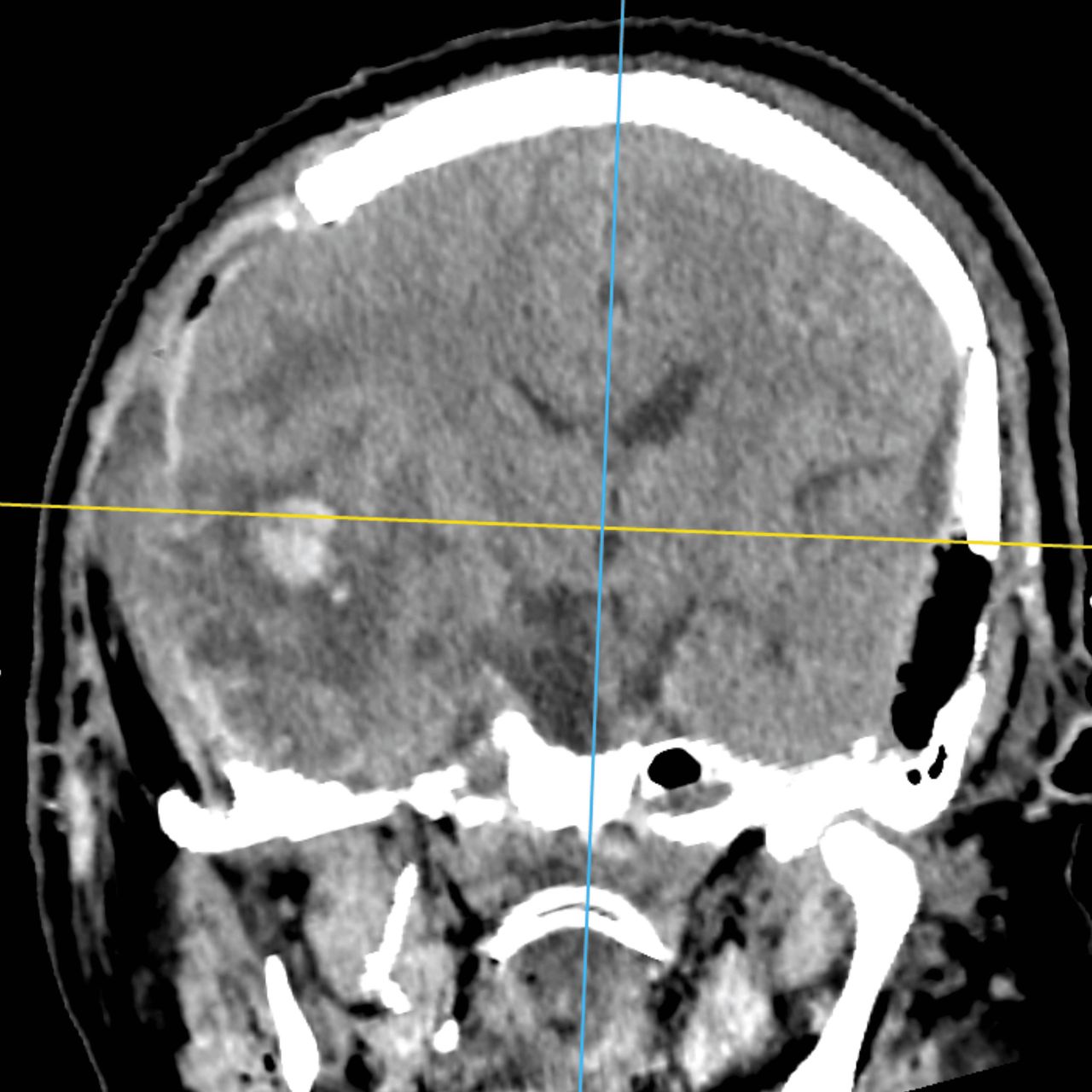 David Tafur Muñoz-2353