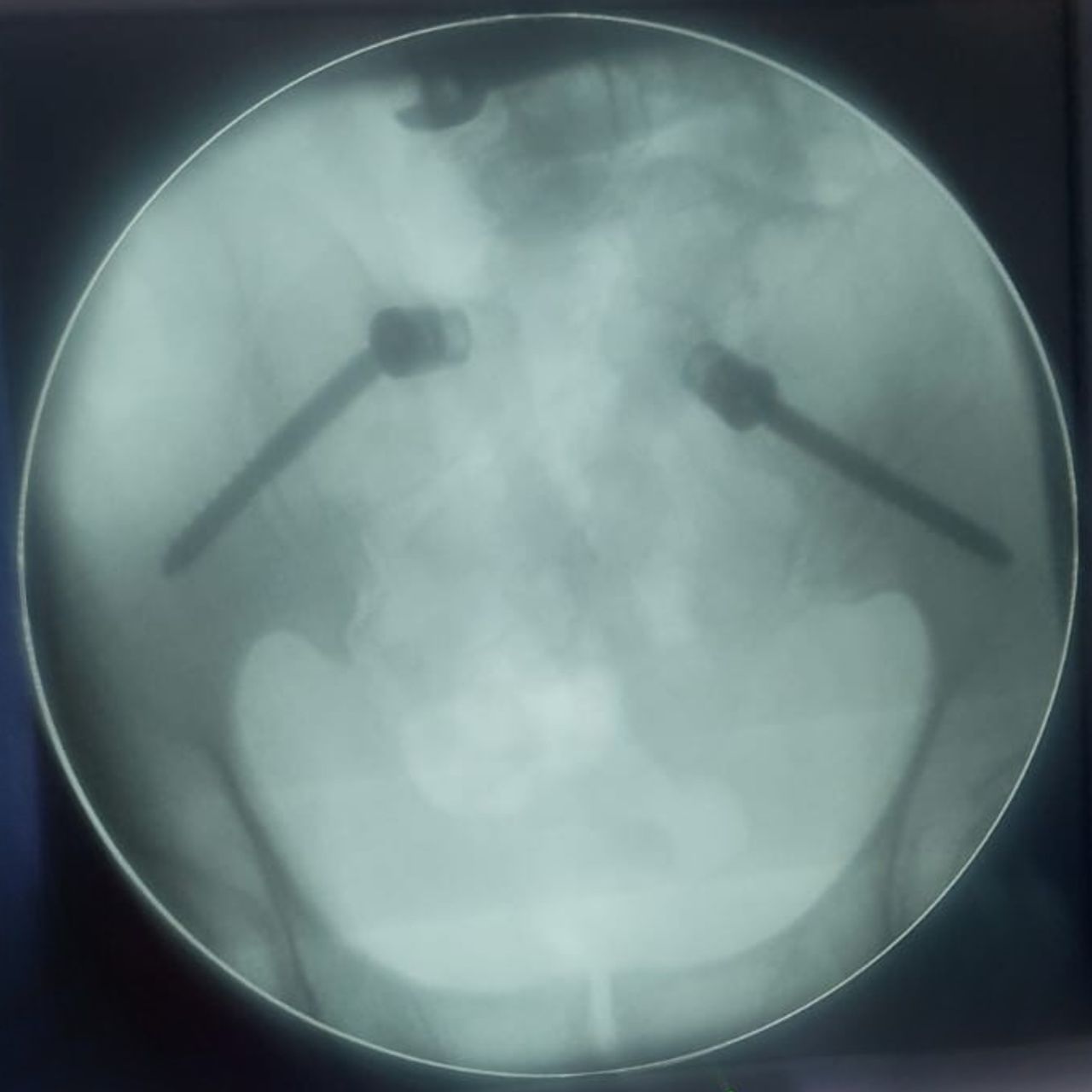 David Tafur Muñoz-1903