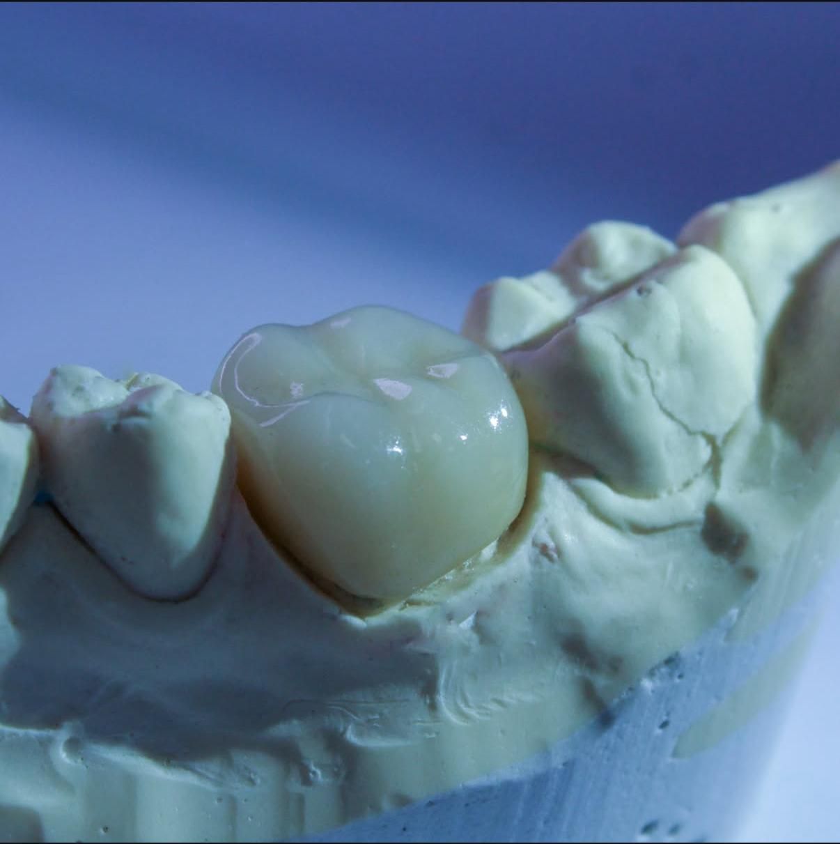 Gyovanne Gydeonne Junior Da Cunha Oliveira-4