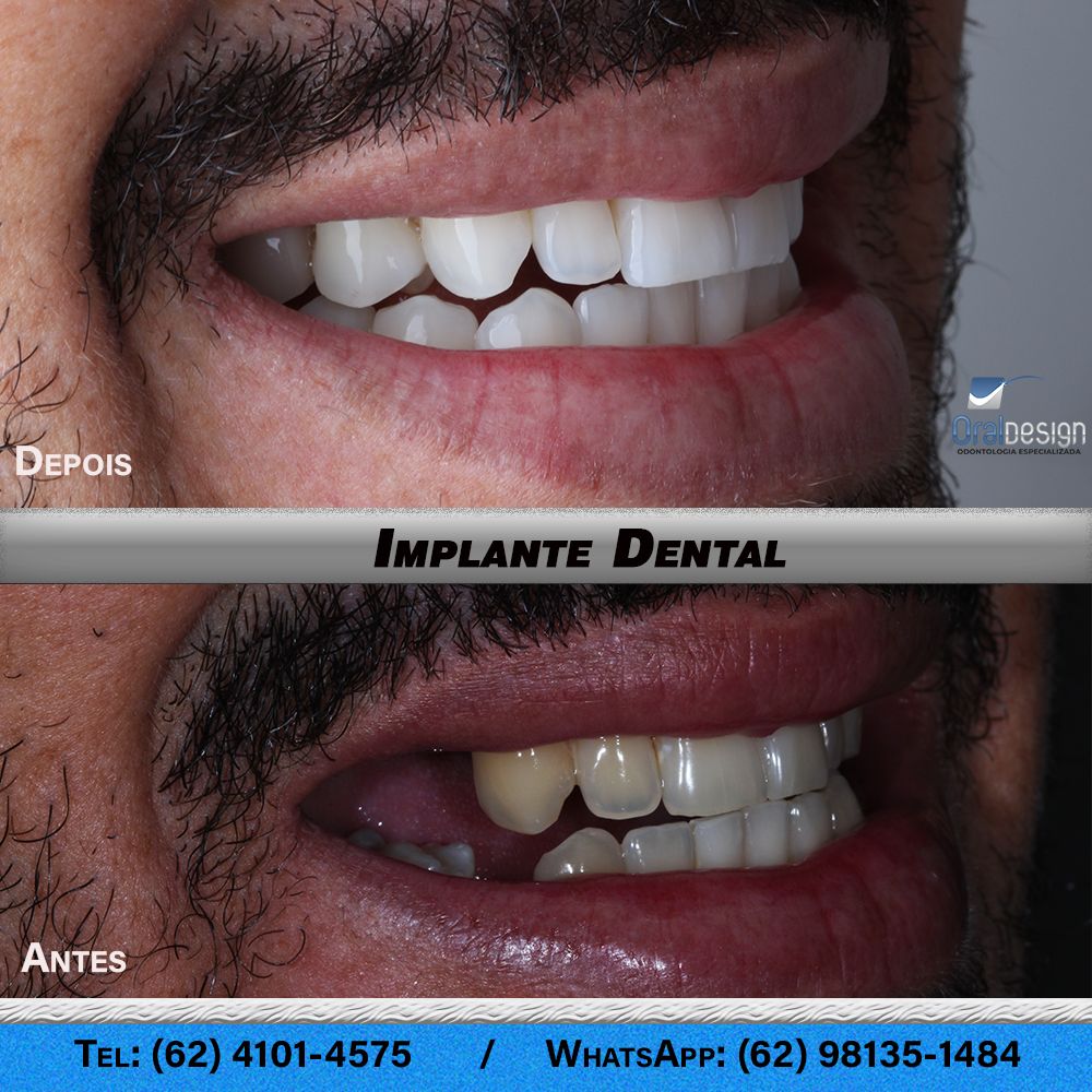 Danilo Monteiro Rezende Pereira-12