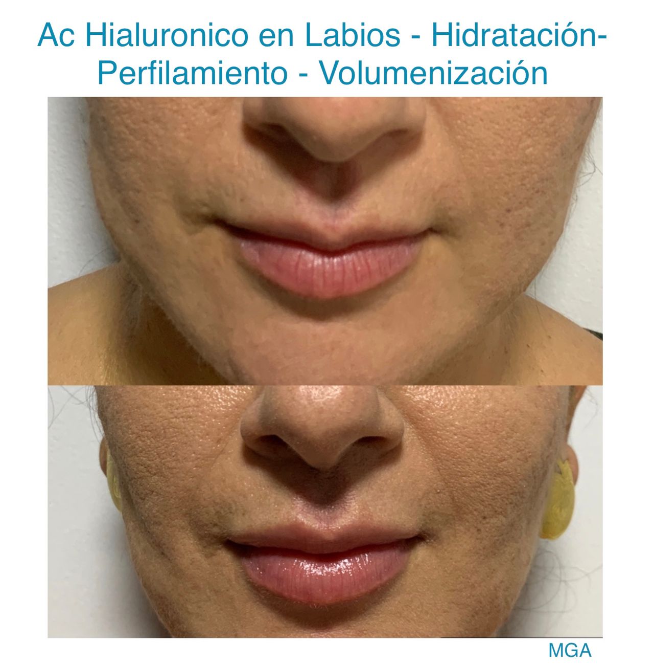 Maria Gisela Angel Losada-7