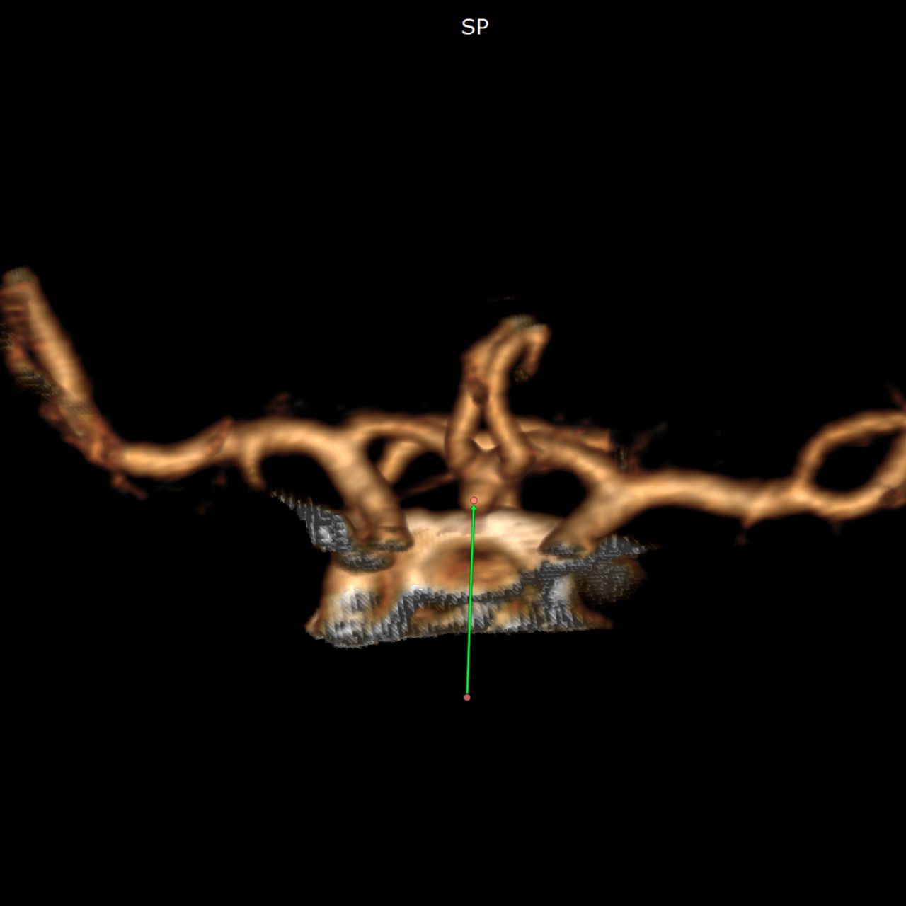 David Tafur Muñoz-2162