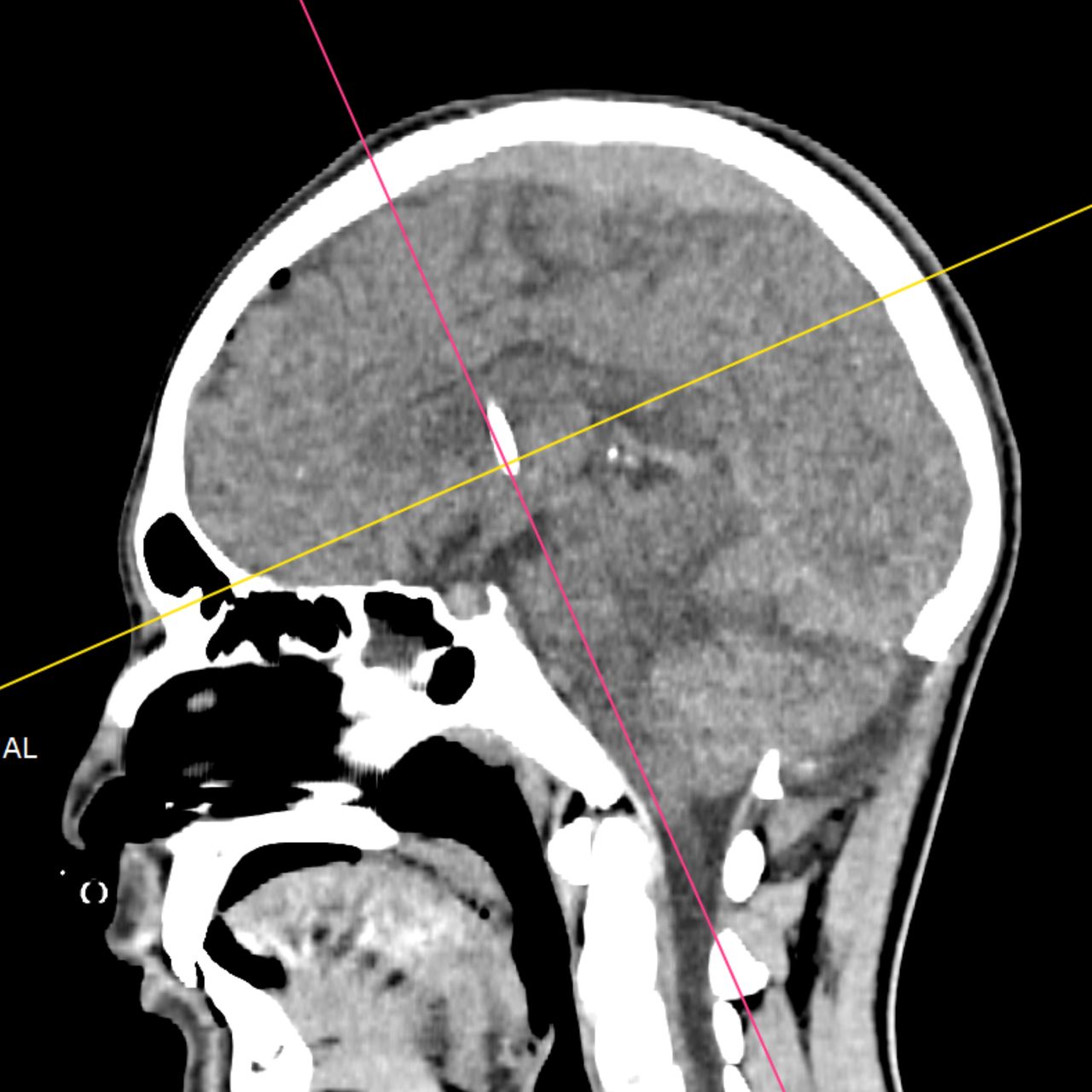 David Tafur Muñoz-1603