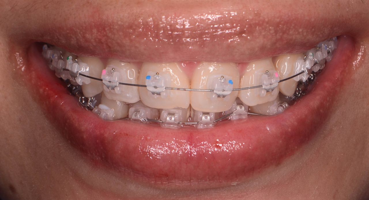 Edith Molina Miranda-13