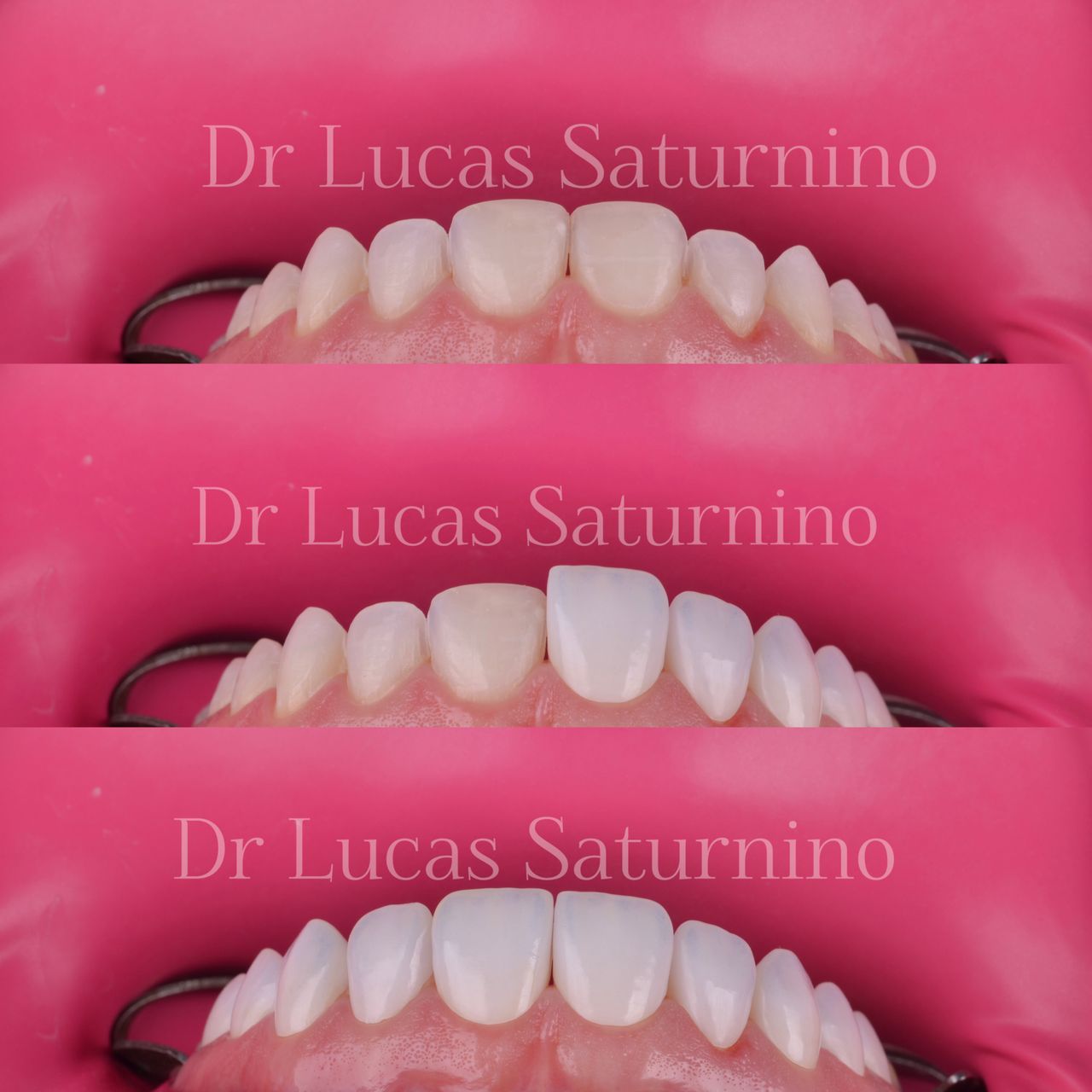 Lucas  Saturnino-5
