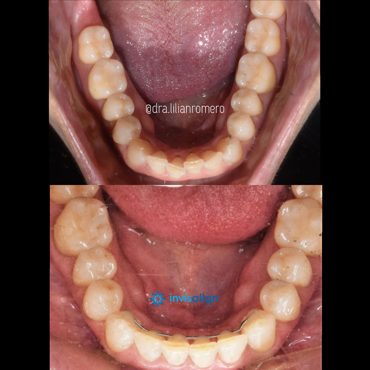 Lilian Catalina Romero Diaz-10