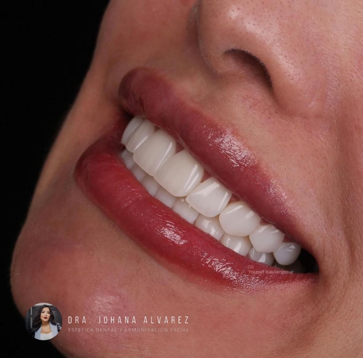 Johana Alvarez Castaño-4