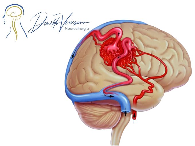 Denildo Veríssimo-17