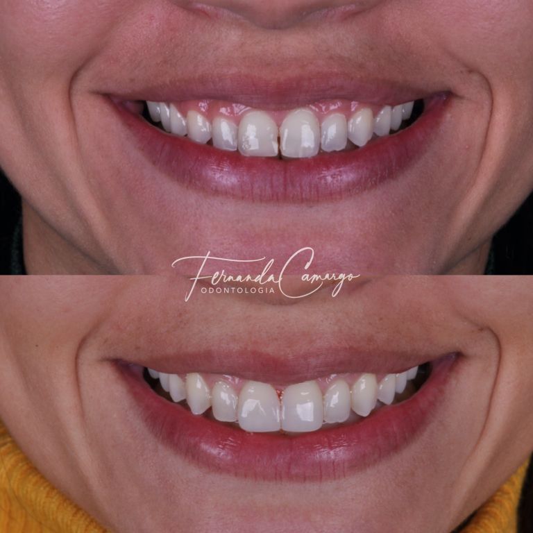 Fernanda Camargo Silveira-0