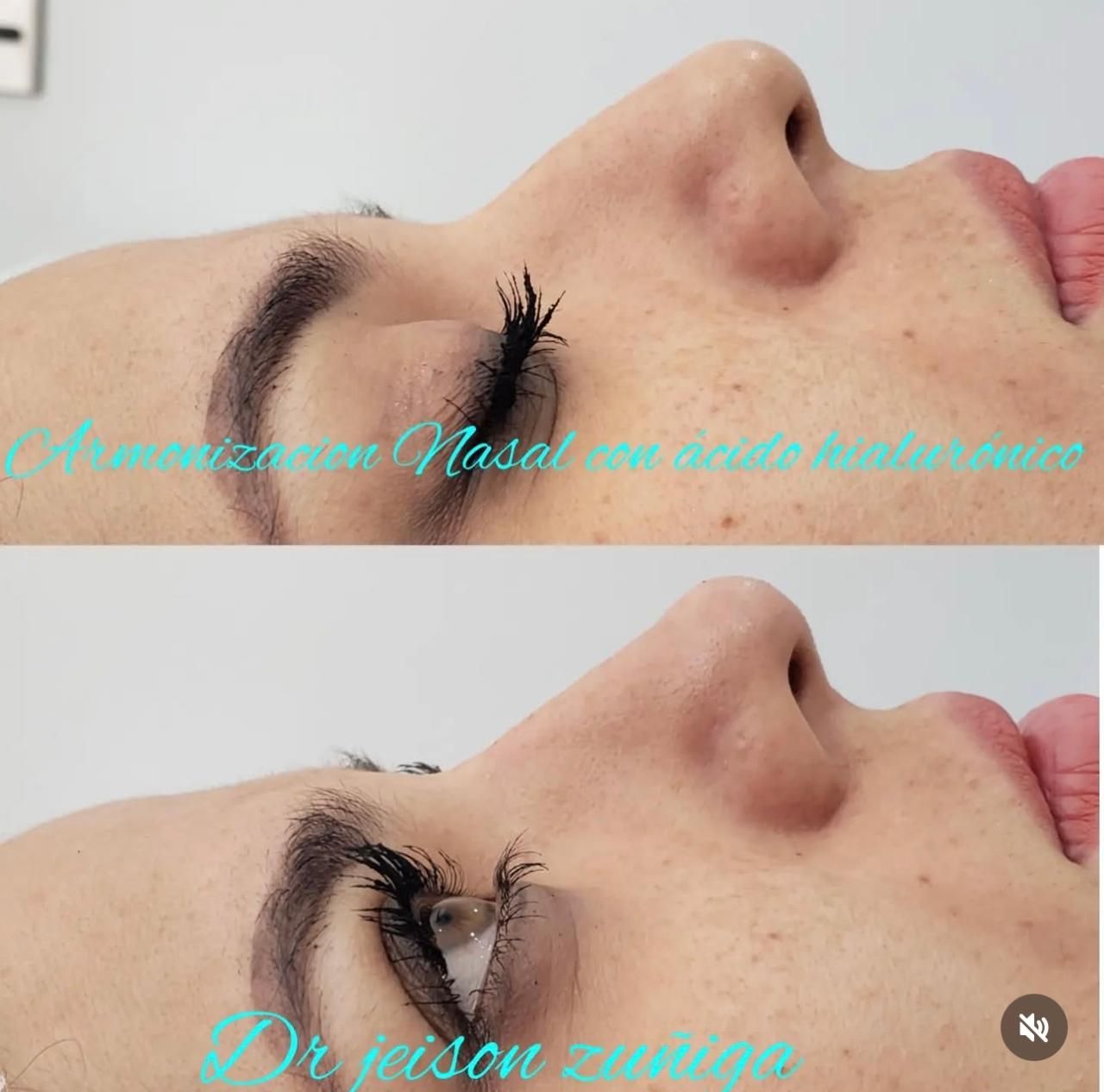 Jeison De Jesus Zuñiga Lara-6