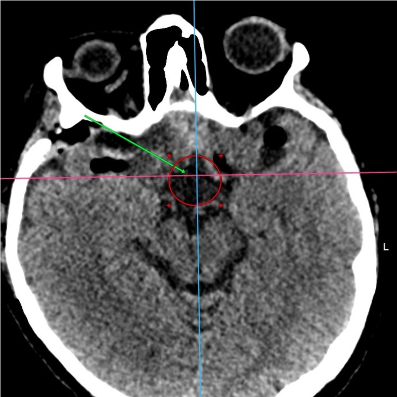 David Tafur Muñoz-1377
