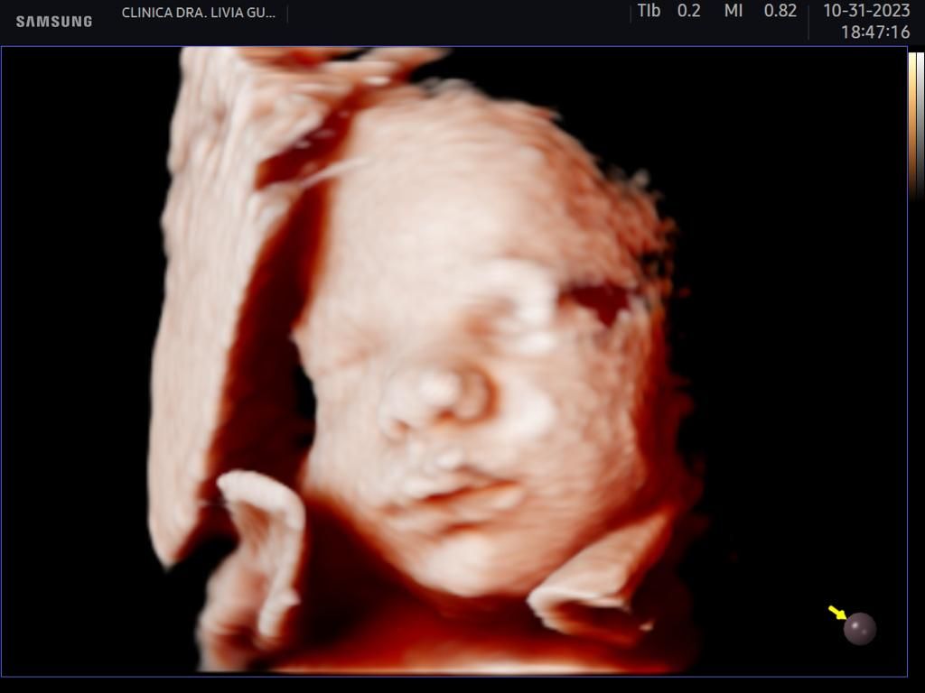 Livia Campelo Guerra Ribeiro-2