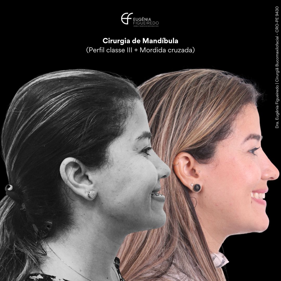 Eugênia Figueiredo-41