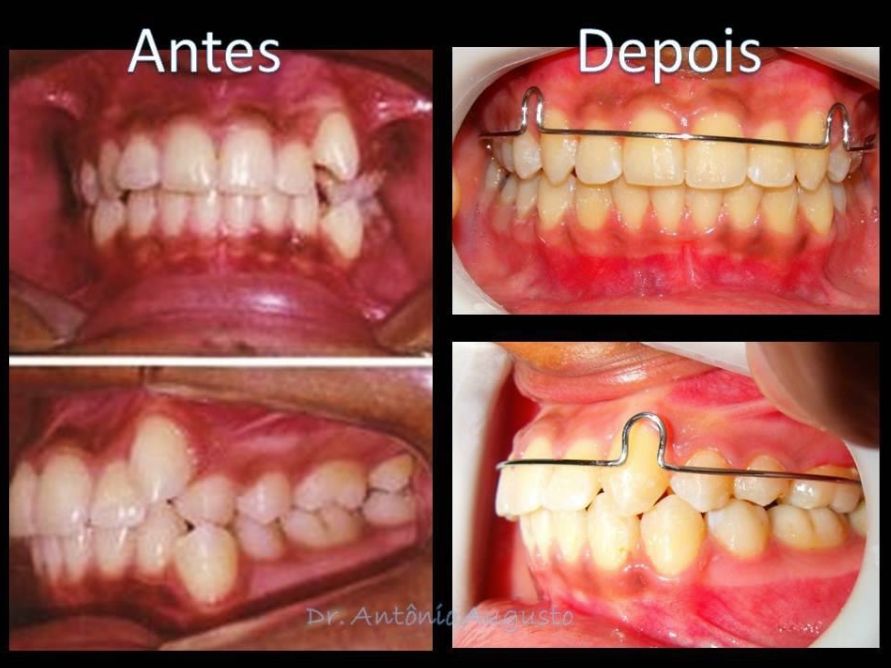 Antônio Augusto Lima De Almeida-11