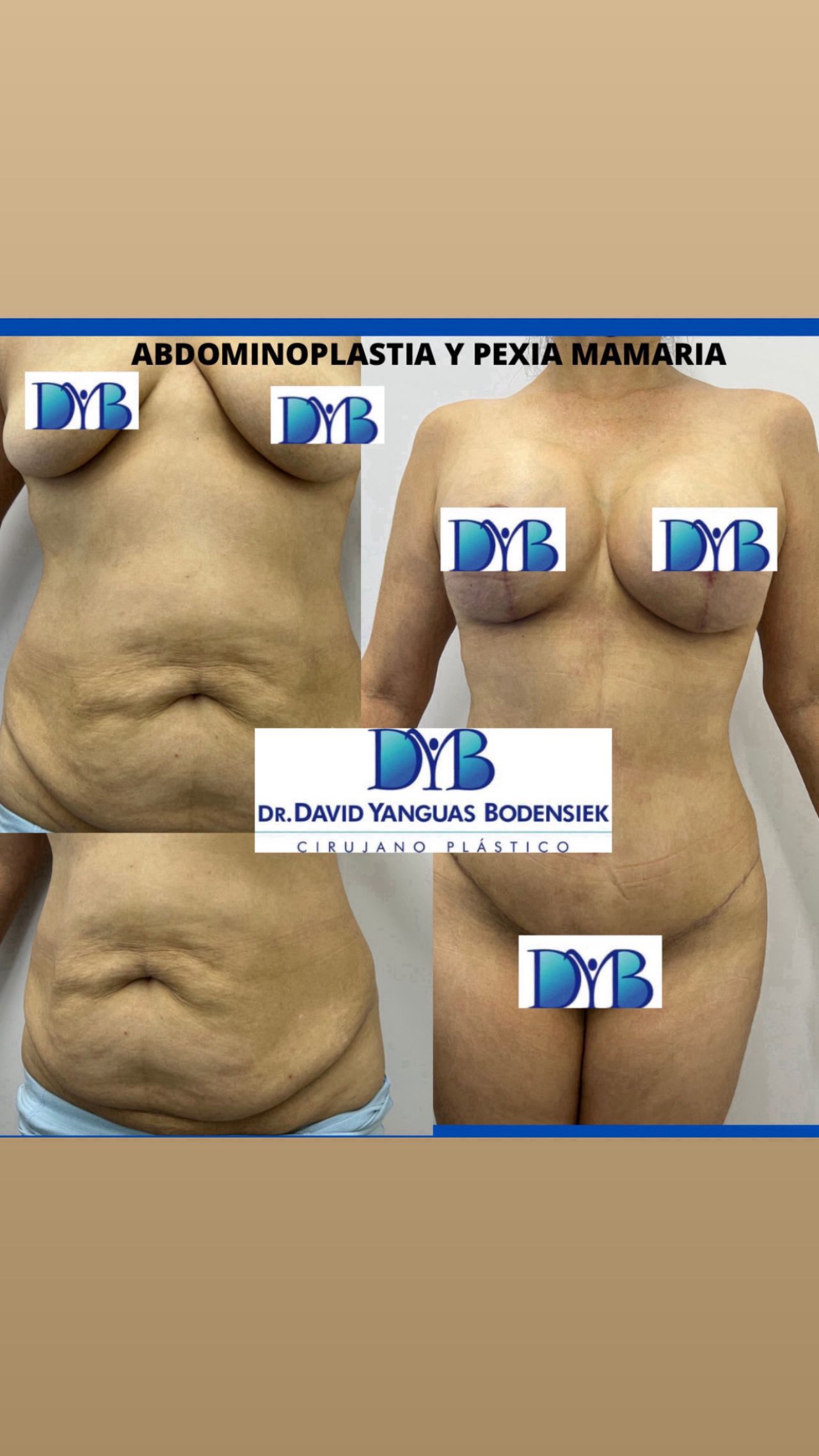 David Yanguas Bodensiek-0