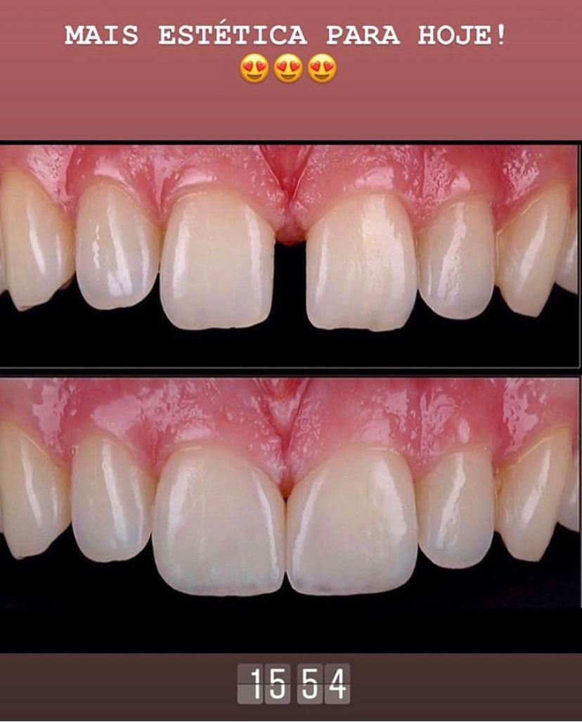 Leandro Ponte Dias-35