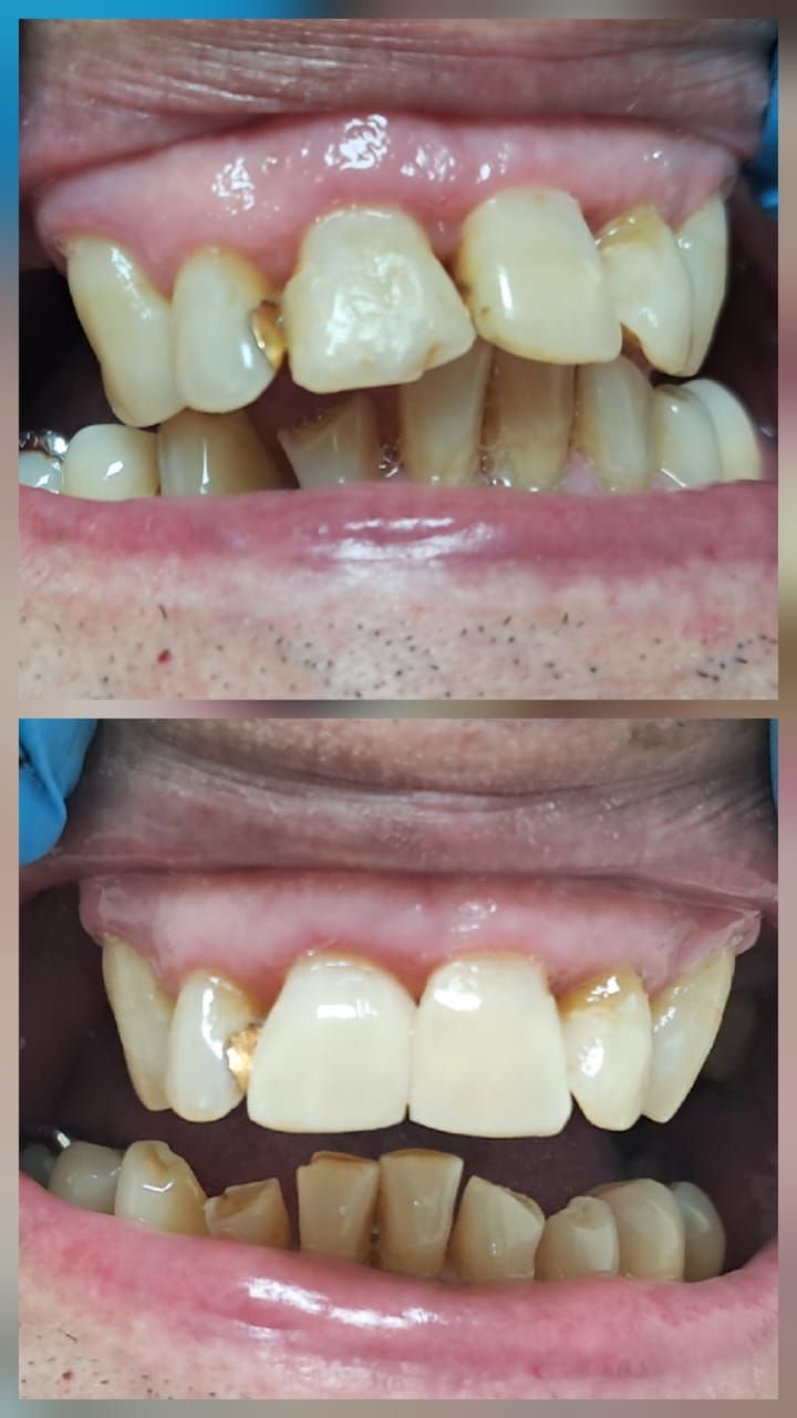 Yuset Almeida Urquiaga-2