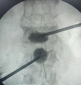 Julio César Uturunco Flores-0