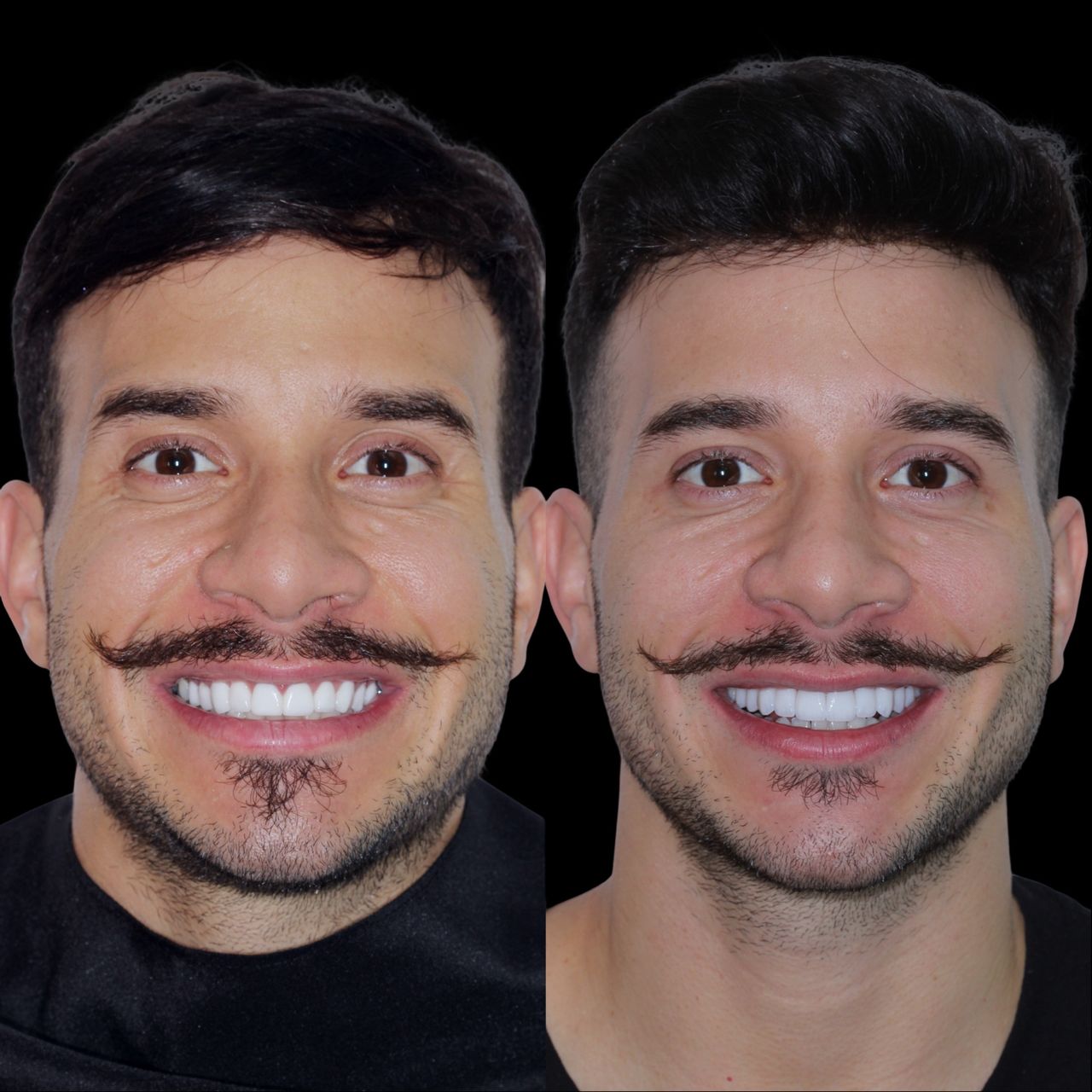 Caroline Benedeti-35