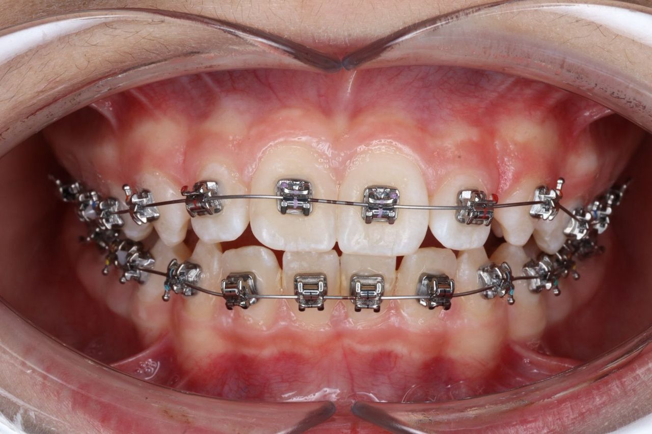 Rodrigo Hodar Dinamarca-10