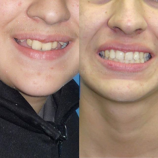 Leandro G. Milito-20